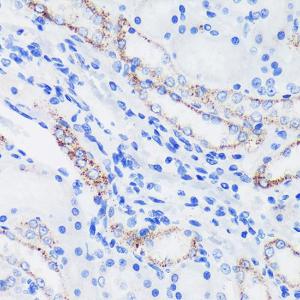 Immunohistochemistry analysis of paraffin-embedded rat kidney using Anti-Epsin 1 Antibody (A306760) at a dilution of 1:100 (40x lens). Perform microwave antigen retrieval with 10 mM PBS buffer pH 7.2 before commencing with IHC staining protocol