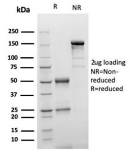 SDS-PAGE analysis of Anti-S100 beta Antibody [S100B/4149] under non-reduced and reduced conditions; showing intact IgG and intact heavy and light chains, respectively. SDS-PAGE analysis confirms the integrity and purity of the antibody.