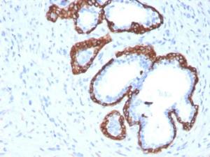 Anti-Cytokeratin 5 Mouse Monoclonal Antibody [clone: KRT5/3594]