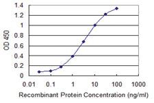 Anti-TFB2M Mouse Monoclonal Antibody [clone: 2E10]