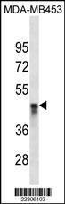 Anti-AGT Mouse Monoclonal Antibody [clone: 656CT5.8.4]