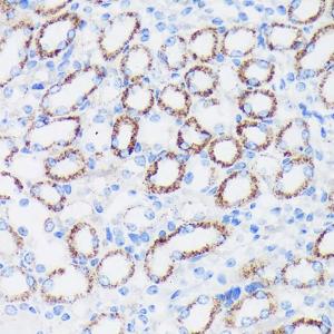 Immunohistochemistry analysis of paraffin-embedded mouse kidney using Anti-Epsin 1 Antibody (A306760) at a dilution of 1:100 (40x lens). Perform microwave antigen retrieval with 10 mM PBS buffer pH 7.2 before commencing with IHC staining protocol