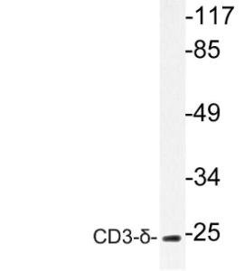 Western blot analysis of lysate from A549 cells using Anti-CD3-delta Antibody