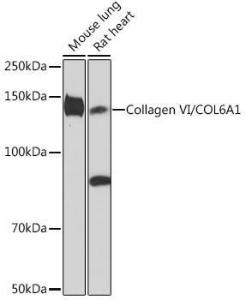 Western blot analysis of extracts of various cell lines, using Anti-Collagen VI Antibody [ARC1725] (A305599) at 1:1,000 dilution. The secondary antibody was Goat Anti-Rabbit IgG H&L Antibody (HRP) at 1:10,000 dilution.