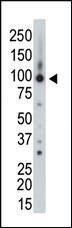 Anti-ARHGAP26 Rabbit Polyclonal Antibody