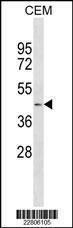 Anti-AGT Mouse Monoclonal Antibody (AP (Alkaline Phosphatase)) [clone: 656CT5.8.4]