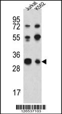 Anti-RPA43 Rabbit Polyclonal Antibody