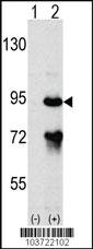 Anti-ARHGAP26 Rabbit Polyclonal Antibody