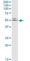 Anti-GTF2H4 Rabbit Polyclonal Antibody