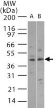 Anti-MAPK11 Rabbit Polyclonal Antibody