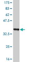 Anti-RIPK2 Mouse Monoclonal Antibody [clone: 6F7]