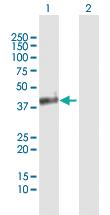 Anti-OLIG2 Rabbit Polyclonal Antibody