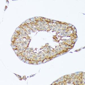 Immunohistochemistry analysis of paraffin-embedded rat testis using Anti-Cortactin Antibody [ARC1613] (A307999) at a dilution of 1:100 (40x lens). Perform microwave antigen retrieval with 10 mM Tris/EDTA buffer pH 9.0 before commencing with IHC staining protocol.