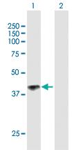 Anti-IL12RB1 Mouse Polyclonal Antibody