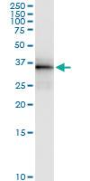 Anti-OLIG2 Rabbit Polyclonal Antibody