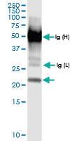 Anti-GLO1 Rabbit Polyclonal Antibody