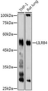 Western blot analysis of extracts of various cell lines, using Anti-ILT-3 Antibody (A12068) at 1:1,000 dilution. The secondary antibody was Goat Anti-Rabbit IgG H&L Antibody (HRP) at 1:10,000 dilution.