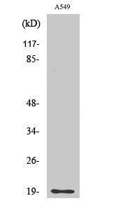 Western blot analysis of various cells using Anti-CD3-delta Antibody