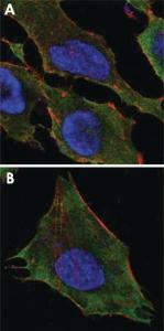 Anti-S100 A10 Mouse Monoclonal Antibody [clone: 4E7E10]