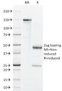 SDS-PAGE analysis of Anti-GM-CSF Antibody [BVD2-21C11] under non-reduced and reduced conditions; showing intact IgG and intact heavy and light chains, respectively. SDS-PAGE analysis confirms the integrity and purity of the Antibody