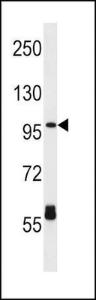 Anti-CPT1C Rabbit Polyclonal Antibody (FITC (Fluorescein Isothiocyanate))