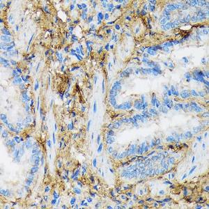 Immunohistochemistry analysis of paraffin-embedded rat lung using Anti-Collagen VI Antibody [ARC1725] (A305599) at a dilution of 1:100 (40x lens). Perform microwave antigen retrieval with 10 mM Tris/EDTA buffer pH 9.0 before commencing with IHC staining protocol.