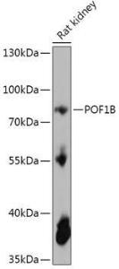 Western blot analysis of extracts of Rat kidney, using Anti-POF1B Antibody (A306762) at 1:1,000 dilution. The secondary antibody was Goat Anti-Rabbit IgG H&L Antibody (HRP) at 1:10,000 dilution.