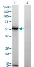 Anti-ASAH1 Mouse Monoclonal Antibody [clone: 1A7]