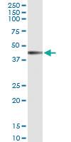 Anti-IL12RB1 Rabbit Polyclonal Antibody