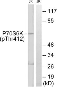 Western blot analysis of lysates from Jurkat cells treated with Insulin 0.01U/ml 15' using Anti-p70 S6 Kinase (phospho Thr389) Antibody. The right hand lane represents a negative control, where the antibody is blocked by the immunising peptide