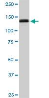 Anti-GTF2I Mouse Polyclonal Antibody