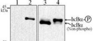 Anti-NFKBIA Mouse Monoclonal Antibody [clone: 39A1413]