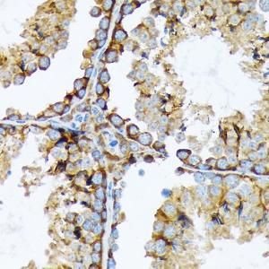 Immunohistochemistry analysis of paraffin-embedded mouse testis using Anti-Cortactin Antibody [ARC1613] (A307999) at a dilution of 1:100 (40x lens). Perform microwave antigen retrieval with 10 mM Tris/EDTA buffer pH 9.0 before commencing with IHC staining protocol.