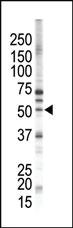 Anti-PACSIN1 Rabbit Polyclonal Antibody