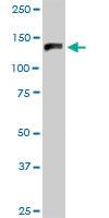 Anti-GTF2I Mouse Polyclonal Antibody