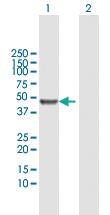 Anti-CK20 Rabbit Polyclonal Antibody