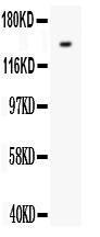 Anti-VEGF Receptor 1 Rabbit Polyclonal Antibody