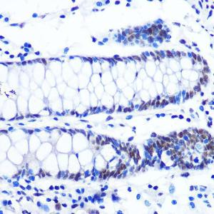 Immunohistochemistry analysis of paraffin-embedded human colon tissue using Anti-NRF1 Antibody [ARC0768] (A306763) at a dilution of 1:100 (40X lens). Perform microwave antigen retrieval with 10 mM PBS buffer pH 7.2 before commencing with IHC staining protocol