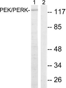 Western blot analysis of lysates from MCF-7 cells using Anti-PERK Antibody. The right hand lane represents a negative control, where the antibody is blocked by the immunising peptide