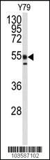 Anti-PACSIN1 Rabbit Polyclonal Antibody