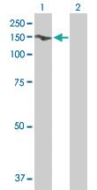 Anti-GTF2I Mouse Polyclonal Antibody