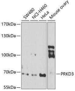 Western blot analysis of extracts of various cell lines, using Anti-PKC nu/PRKD3 Antibody (A12069) at 1:1,000 dilution The secondary antibody was Goat Anti-Rabbit IgG H&L Antibody (HRP) at 1:10,000 dilution Lysates/proteins were present at 25 µg per lane