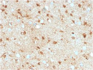 Immunohistochemical analysis of formalin-fixed, paraffin-embedded human brain tissue using Anti-S100 beta Antibody [S100B/4149] at 2µg/ml