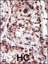 Anti-PACSIN1 Rabbit Polyclonal Antibody