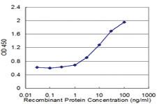 Anti-ASAH1 Mouse Monoclonal Antibody [clone: 1A7]