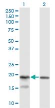 Anti-KLRC4 Mouse Monoclonal Antibody [clone: 1D10]