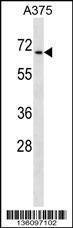 Anti-CDYL Rabbit Polyclonal Antibody (HRP (Horseradish Peroxidase))