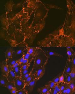 Immunofluorescence analysis of C6 cells using Anti-Cortactin Antibody [ARC1613] (A307999) at a dilution of 1:100 (40x lens). DAPI was used to stain the cell nuclei (blue).