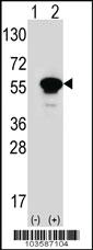 Anti-PACSIN1 Rabbit Polyclonal Antibody