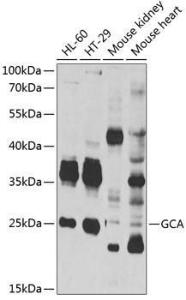 Western blot analysis of extracts of various cell lines, using Anti-Grancalcin Antibody (A12070) at 1:1,000 dilution The secondary antibody was Goat Anti-Rabbit IgG H&L Antibody (HRP) at 1:10,000 dilution Lysates/proteins were present at 25 µg per lane